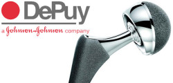 DePuy hip implant lawsuit