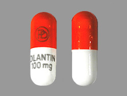 Dilantin side effects