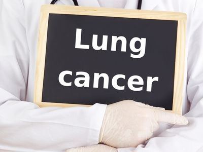 asbestos lung cancer