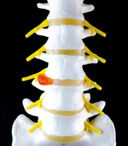vertebrae-spine-model