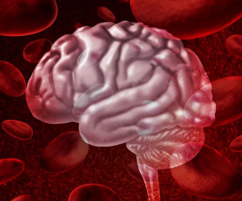 Blood thinners may cause brain hemmorhage