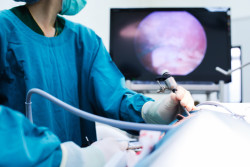 laparoscopic-surgery-morcellator