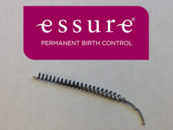 Essure Birth Control