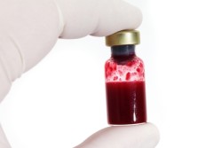Theranos blood testing class action lawsuit