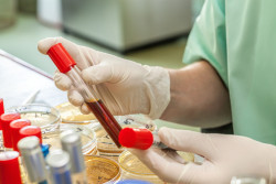 Test tubes in laboratory comparing by lab worker