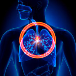 abestos-lung-cancer