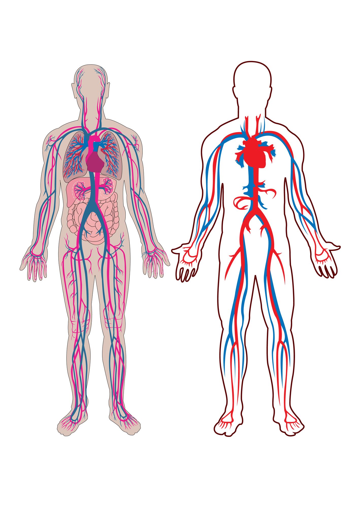 IVC-filter-risks