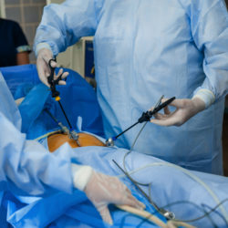 morcellator cancer morcellation laparoscopic surgery