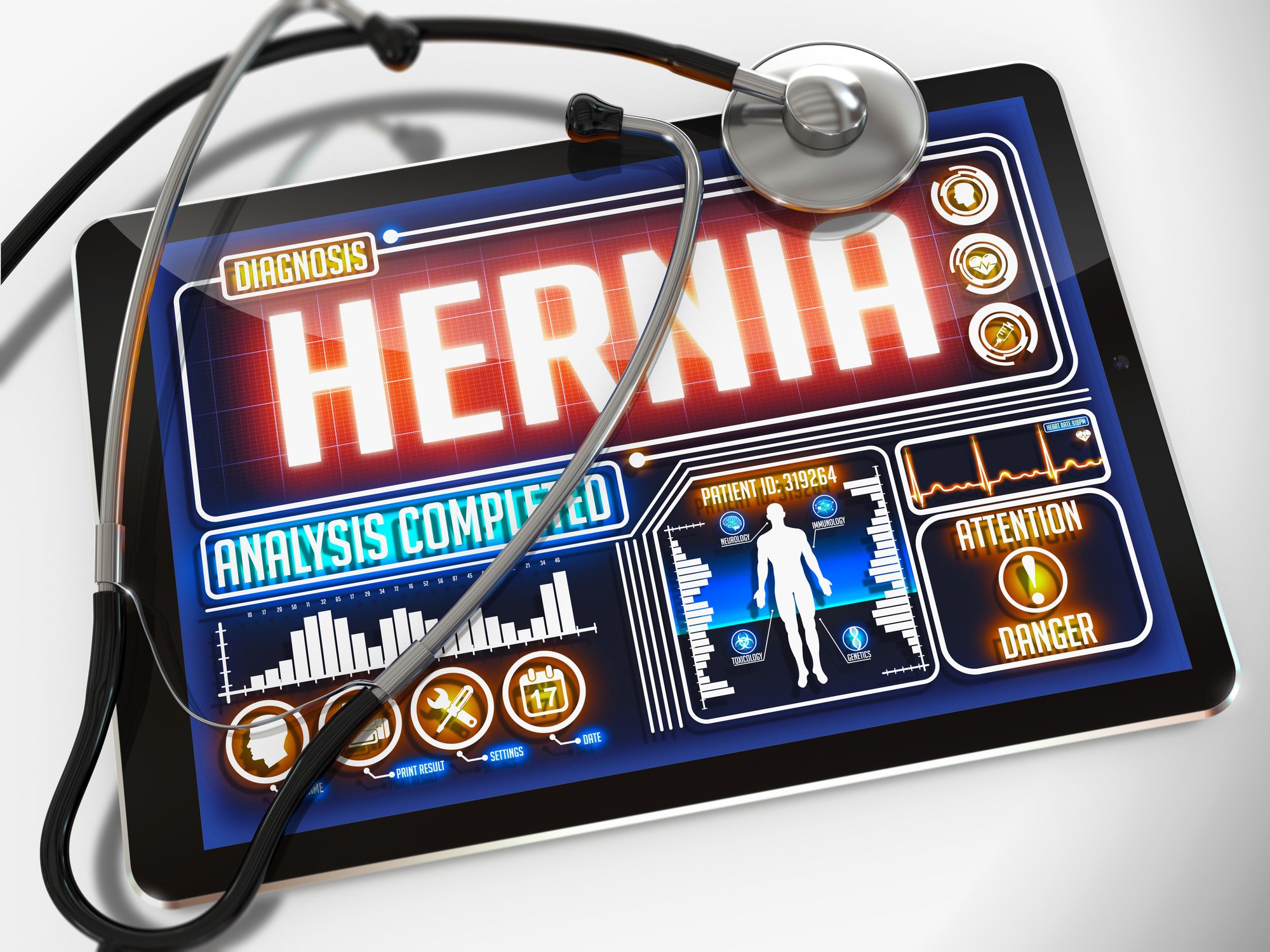 Man Sues Atrium Medical Over Hernia Mesh Reaction
