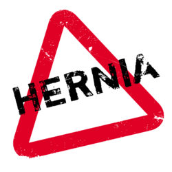 Hernia mesh complications