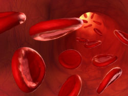 Bard IVC filter complications blood cells