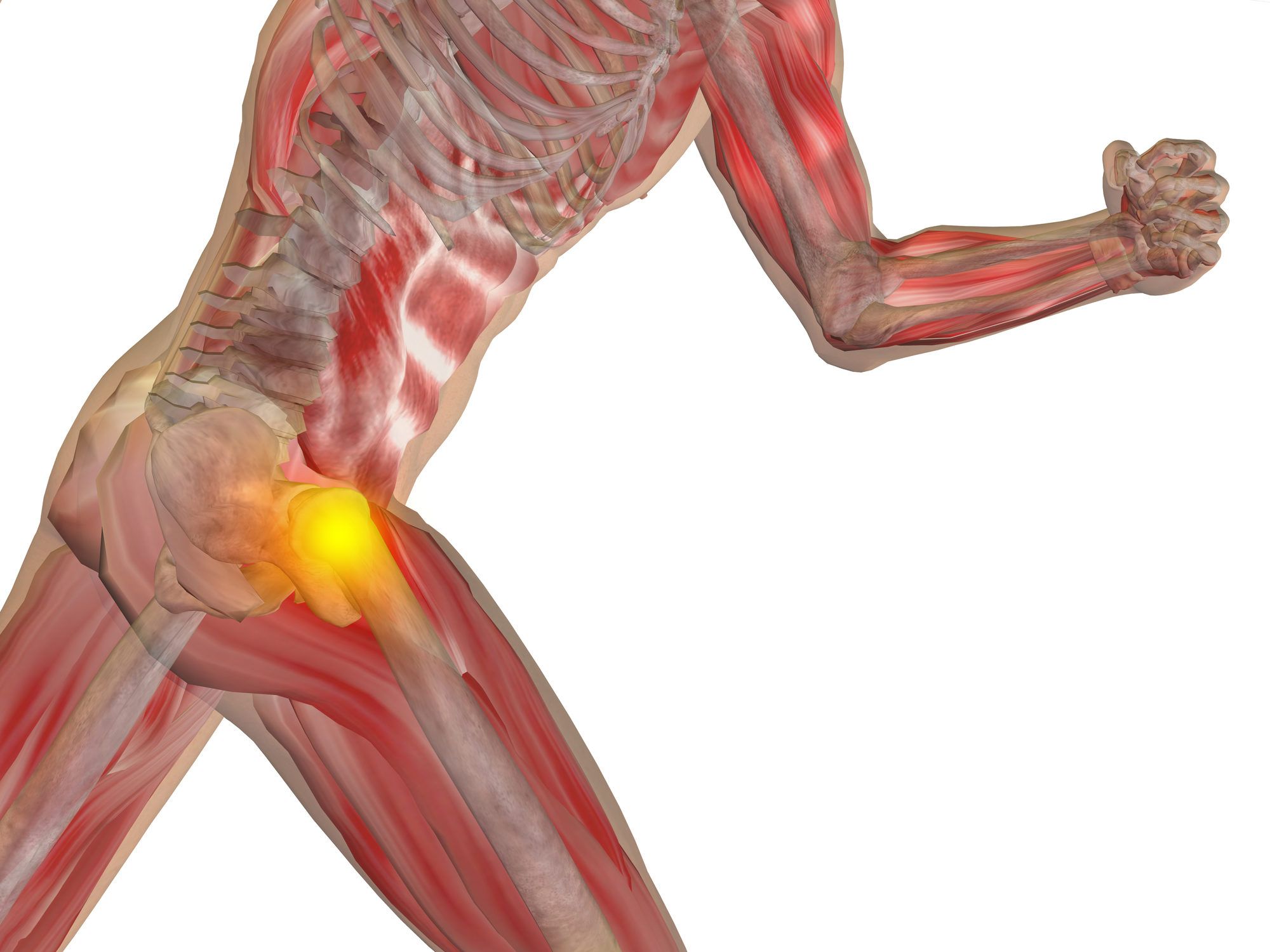 Johnson & Johnson Ordered to Pay 1B in DePuy Metal Hip Implant Lawsuit Top Class Actions