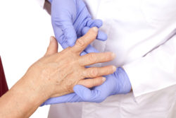 Actemra complications doctor examing hand rheumatoid arthritis