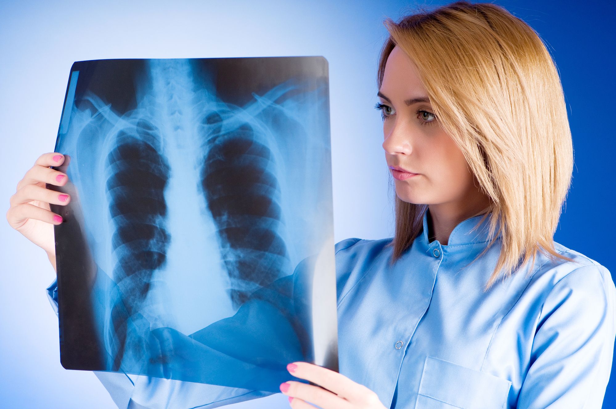 lung-cancer-and-asbestos-exposure