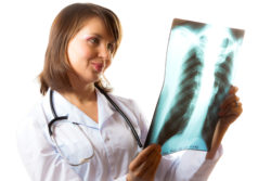 Female doctor analyzes lungs xray image