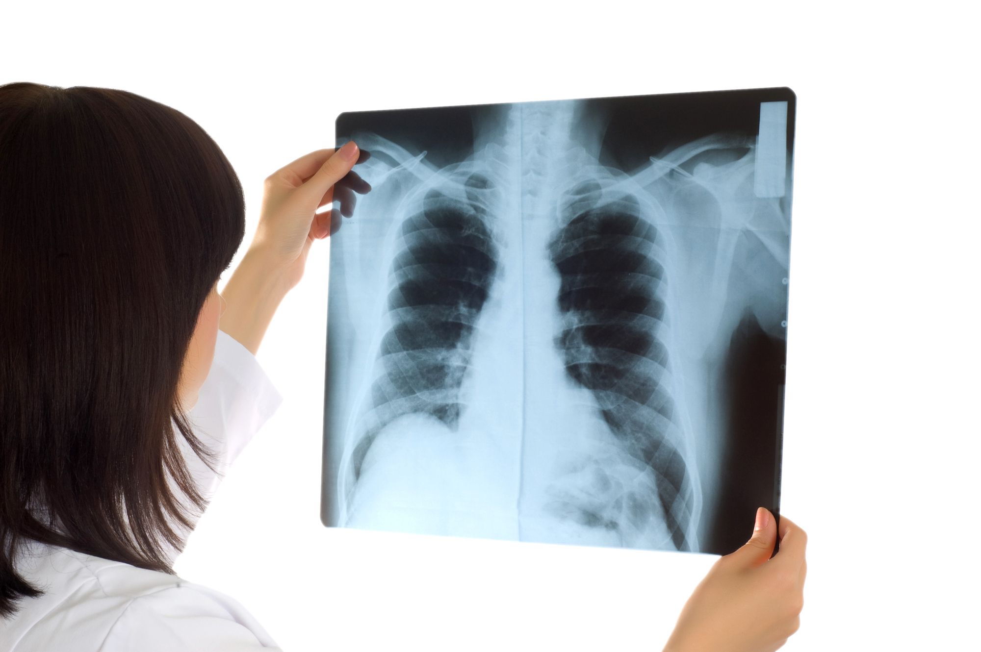 Do You Suffer From an Asbestos-Related Lung Disease?