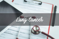 HEALTH CONCEPT: LUNG CANCER