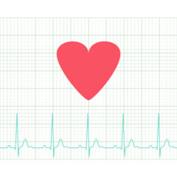 Uloric cardiac ischemia heart EKG