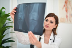 Doctor looking at a radiography