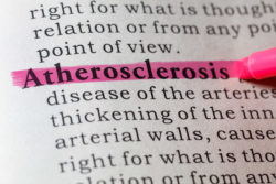 CML Treatment Drug Tasigna Linked with Atherosclerosis Risk
