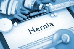 Defective Hernia Mesh Lawsuit Alleges Physiomesh Is Dangerous