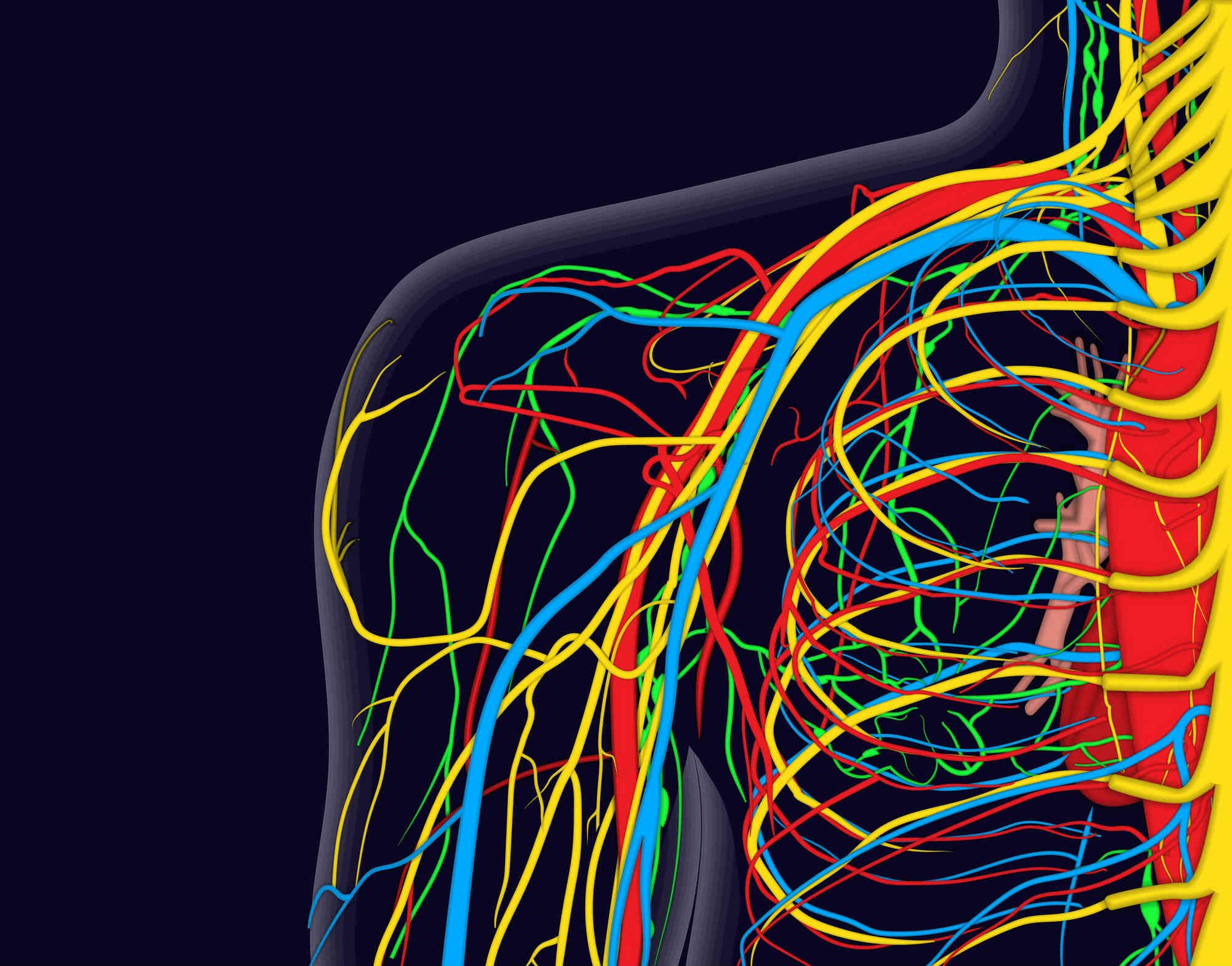 Complications of IVC Filter Placement Include Vein Wall Perforation ...