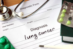 asbestos-lung-cancer-lawsuit