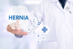 Dr representation of ventral hernia repair