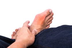 Clinical Trial Indicates Uloric Gout Medicine Linked to Risk of Heart-Related Death