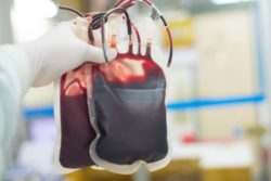 transfusions is necessary for Xarelto GI bleed