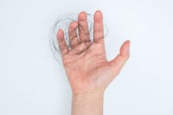 hand holding hair from chemotherapy hair loss