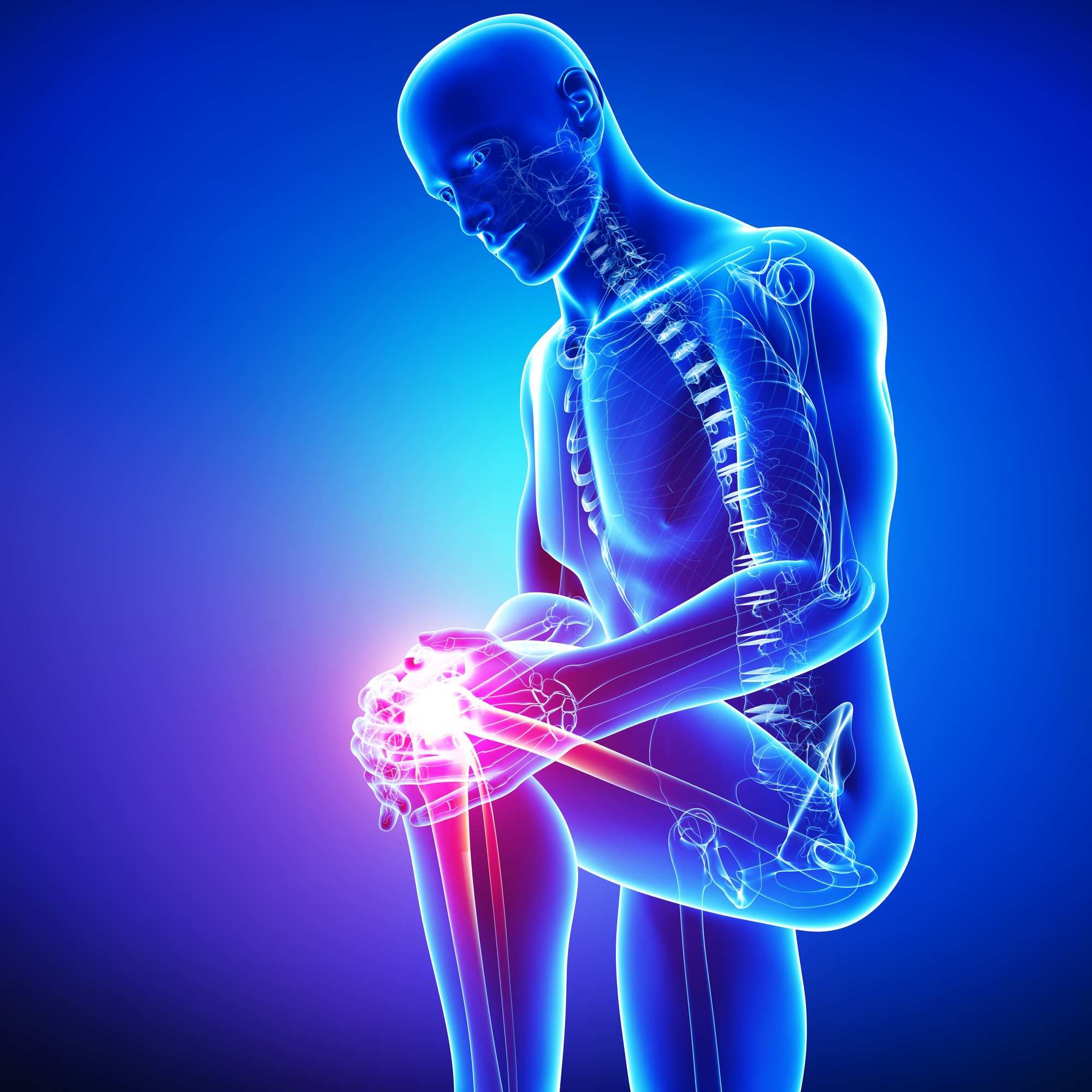 Howmedica Simplex Cement Associated With Knee Replacement Failure Top howmedica-simplex-cement-associated-with-knee-replacement-failure-top