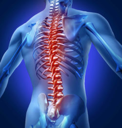 Transverse Myelitis Lawsuit Filed in Federal Court Over Shingles Vaccine