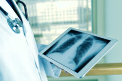 A doctor reviews a chest X-ray.