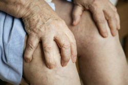 Elderly woman in knee pain