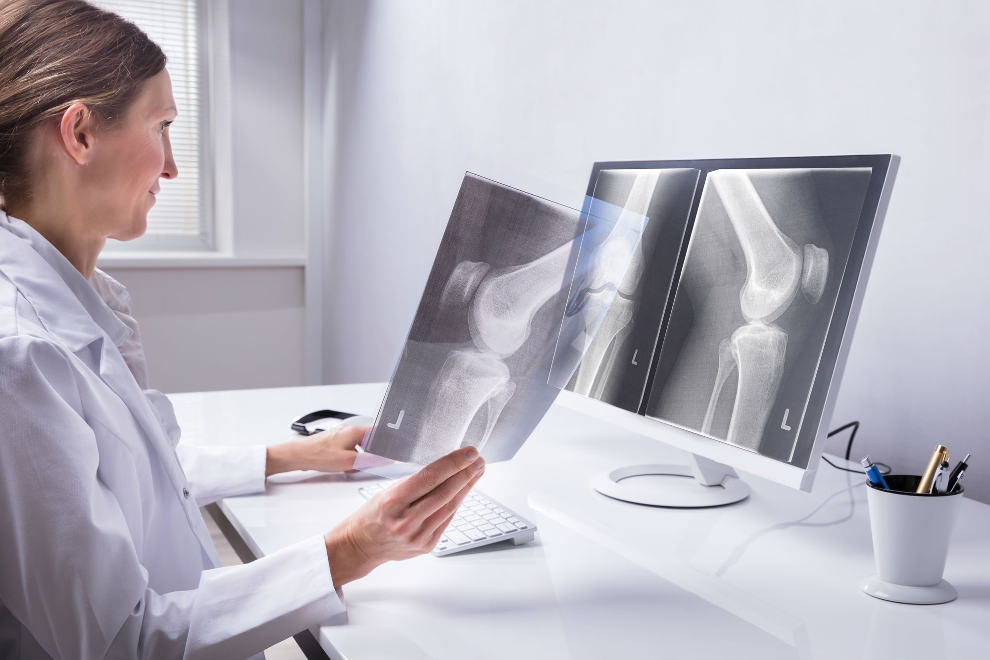 Bone Cement Failure: What Are The Symptoms of Aseptic Loosening? - Top ...