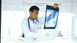 Doctor looks at lung xray