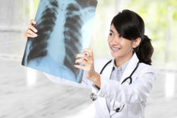 A doctor looks at a lung cancer xray.