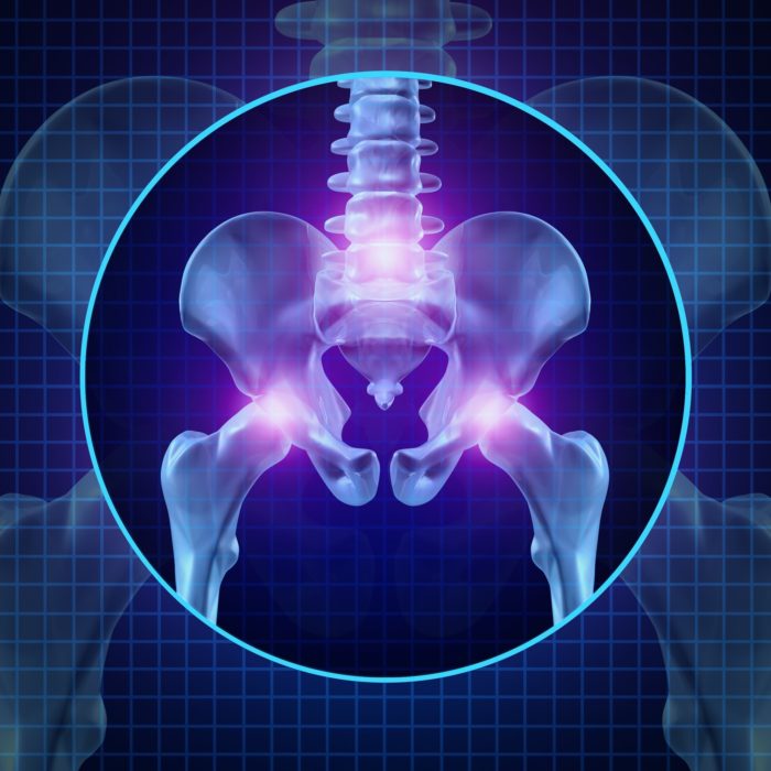 DePuy Hip Replacement Lawsuit Claims Pinnacle Implant is Defective