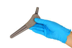 A gloved hand holds a metal hip implant.