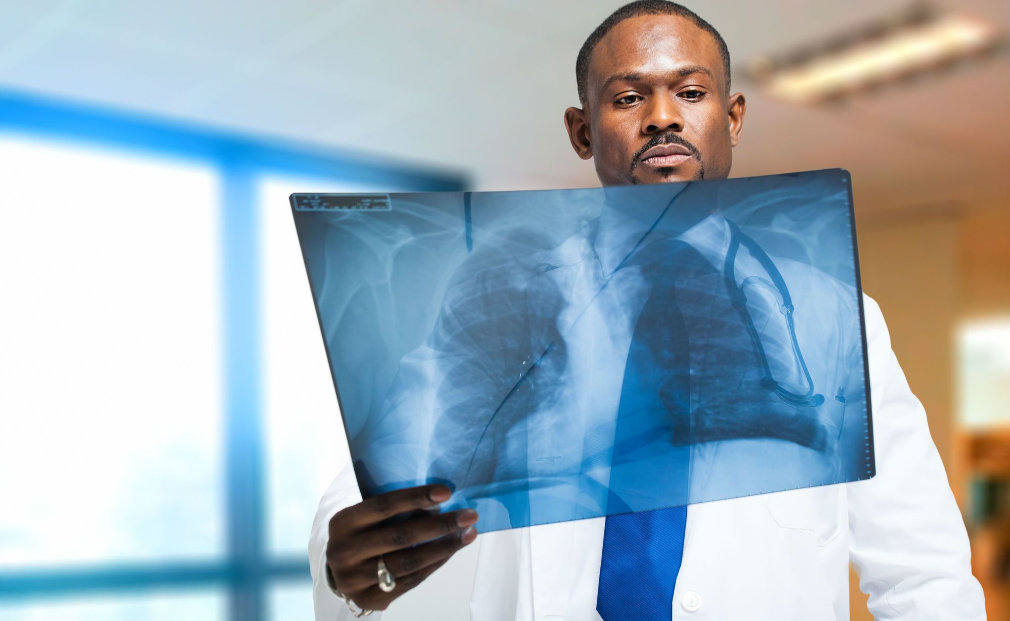 What Causes Black Lung Disease? Top Class Actions