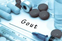 Gout surrounded by treatment options