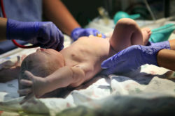 newborns can suffer birth injuries caused by medical negligence