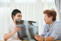 Doctor and patient looking at chest xray