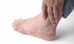 Painful ankle with gout