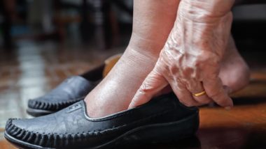 Elderly woman with swollen feet
