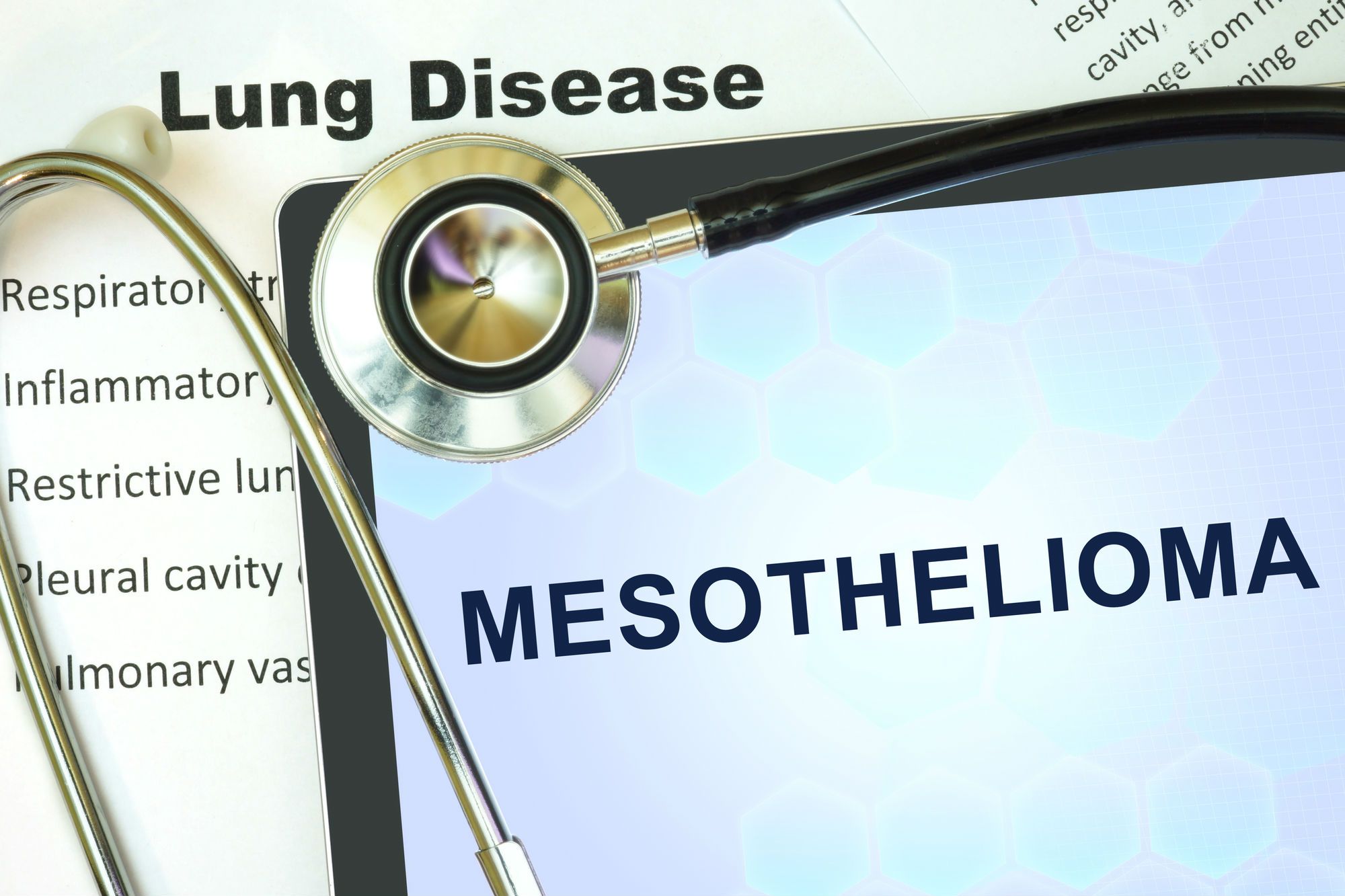 People exposed to asbestos should be aware of the first signs of mesothelioma.
