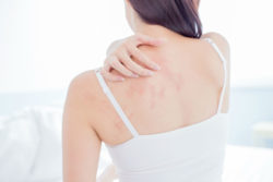 Woman with rash