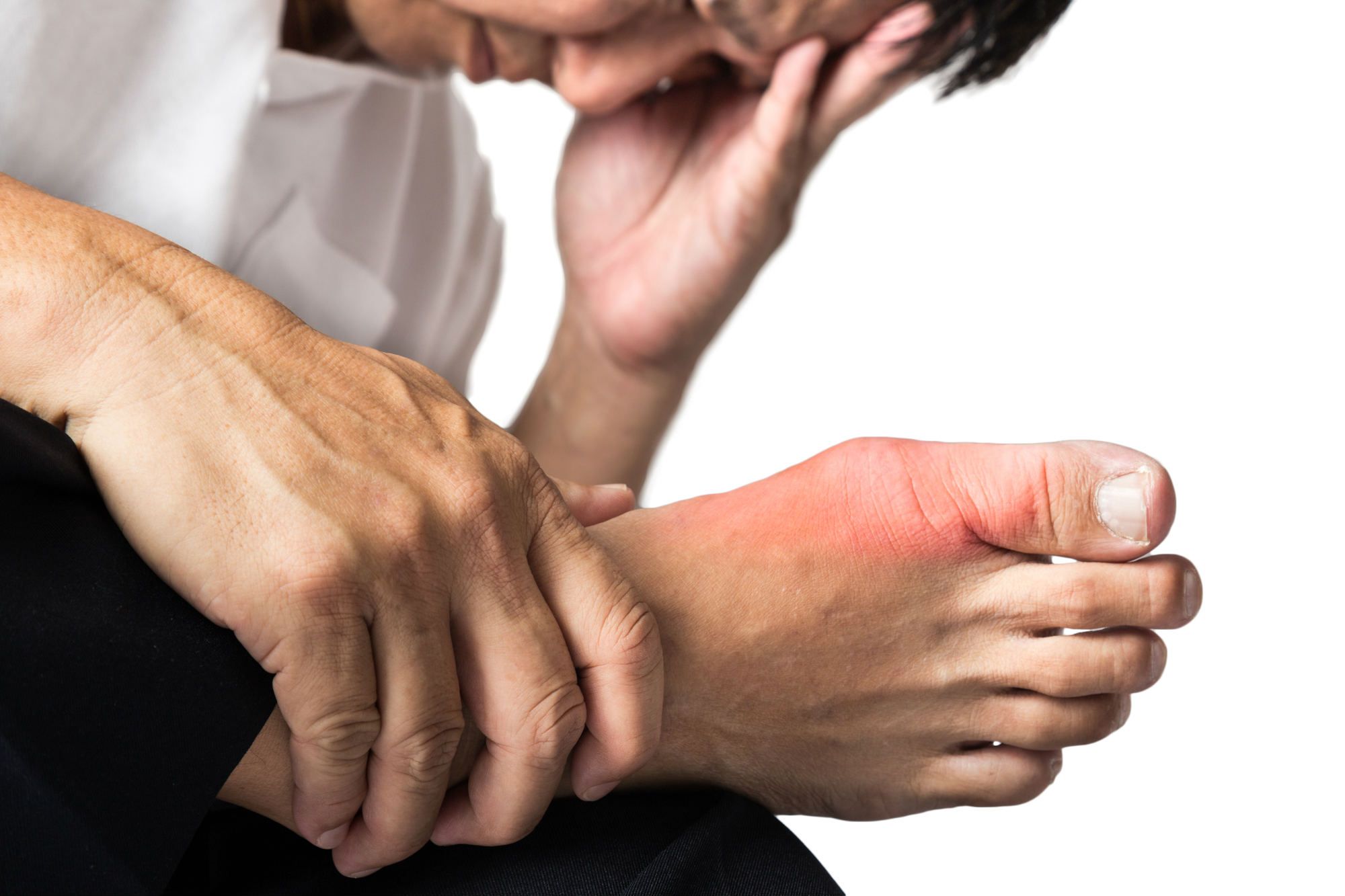 Is It Safe to Take Uloric Medication for Gout?