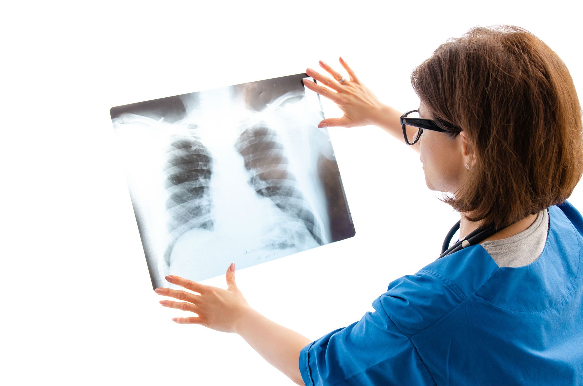 Lung Cancer Awareness Month Highlights Symptoms And Risk Factors - Top 